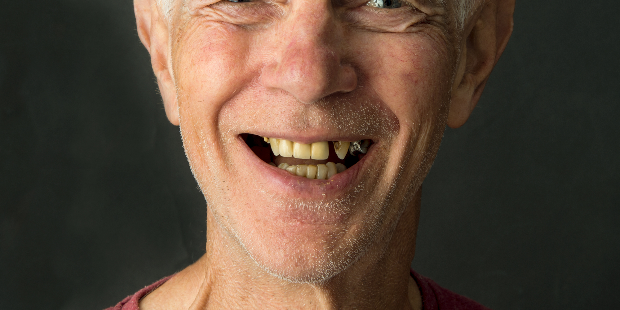 _RCW7648-Norm-Before-V3.jpg