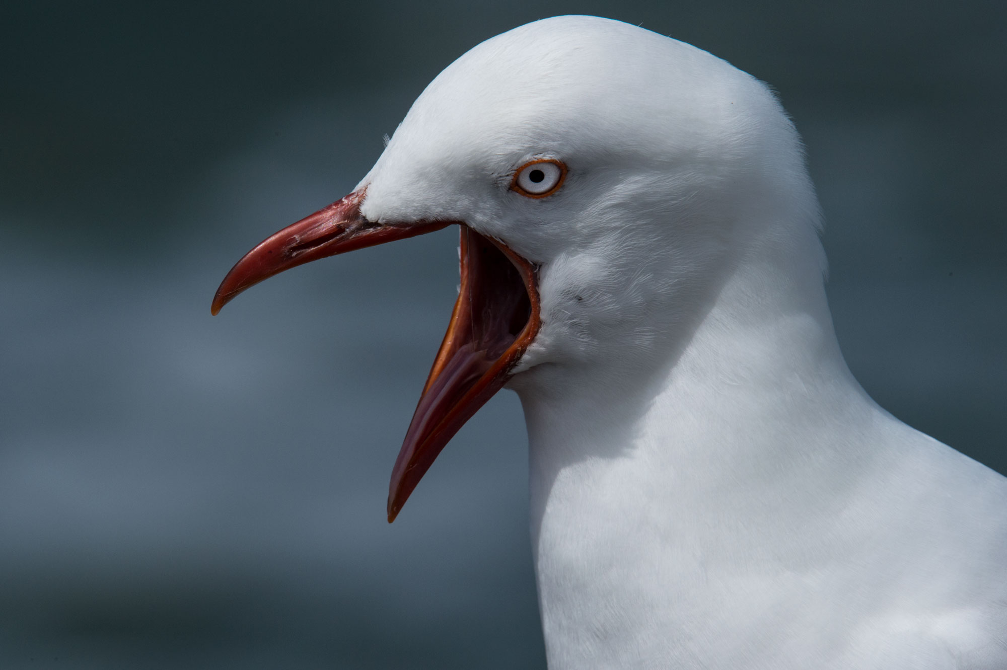 _RCW8072-BIG-YAWN-vIIron winter of fabulous teeth @ seaside dental laboratory & clinic Takapuna Auckland New Zealand.jpg