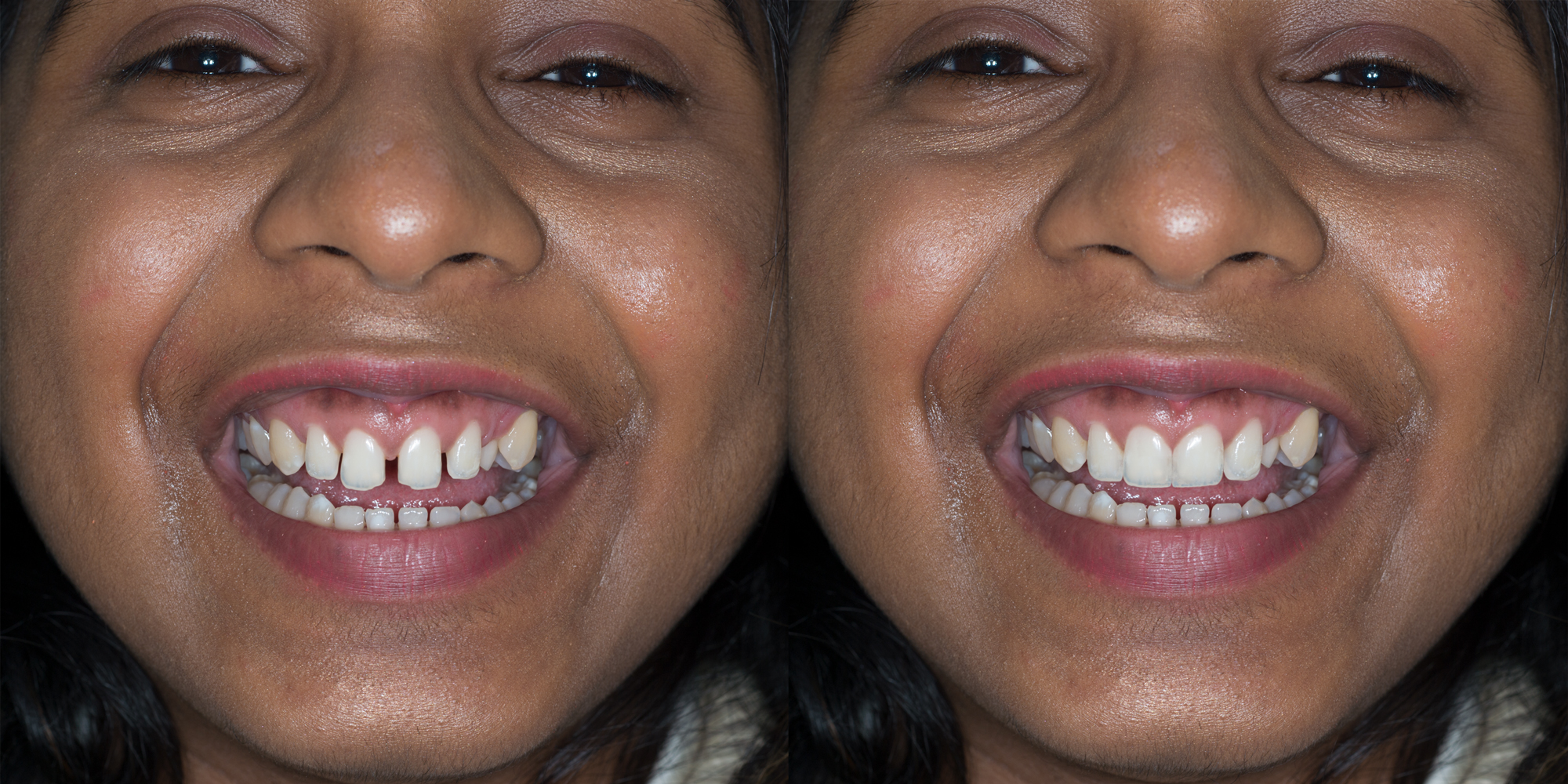 Photo-Realistic-Diagnostics ron winter of fabulous teeth @ seaside dental laboratory & clinic Takapuna Auckland New Zealand.jpg 