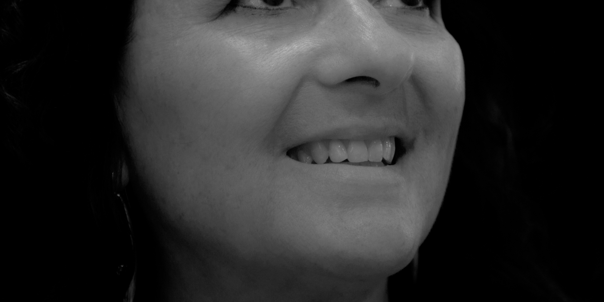 _RCW3413-B--W Full Upper Denture.jpg by Ron Winter of Fabulous Teeth @ Seaside Dental Laboratory Takapuna Auckland New Zealand