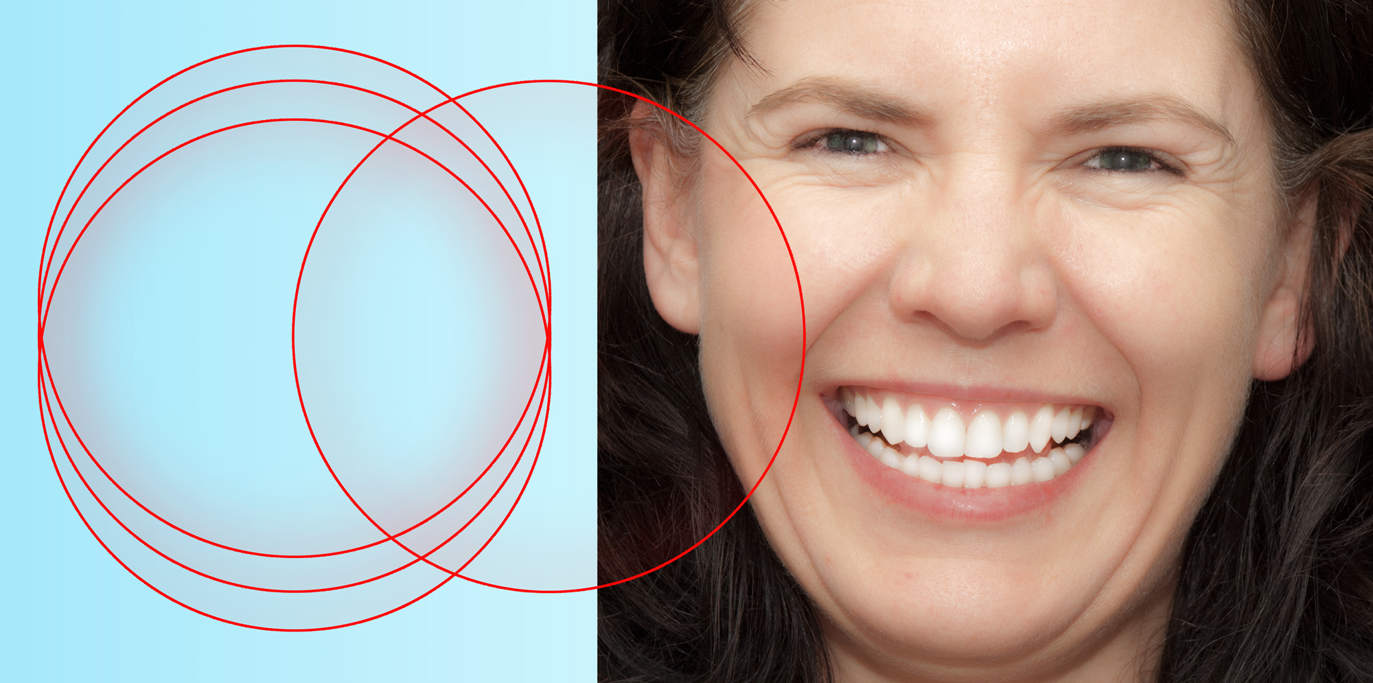 Four-Rings-and-a-smile-by-Ron-Winter--Fabulous-Teeth--Seaside-Dental-Laboratory--Clinic.jpg