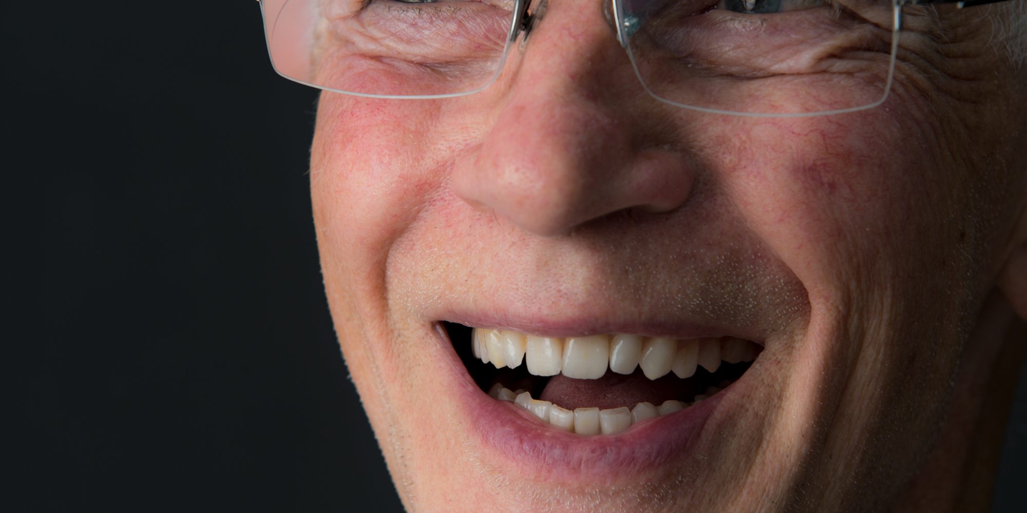 _RW9742-Norm-vI.jpg By Ron Winter of Fabulous Teeth @ Seaside Dental Laboratory Takapuna Auckland New Zealand