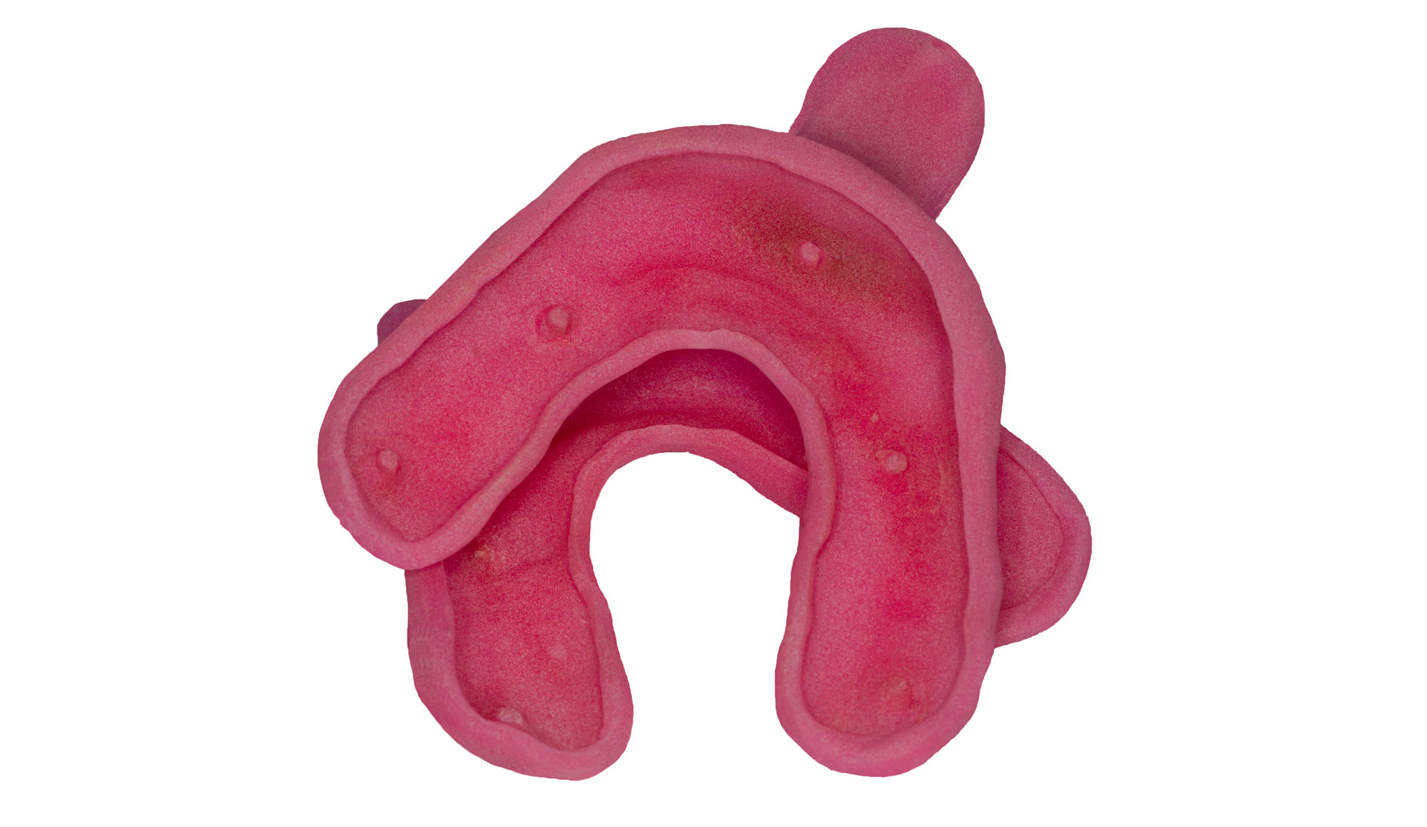 _RCW6137-Custom-Trays by Ron Winter of Fabulous Teeth @ Seaside Dental Laboratory & Clinic.jpg