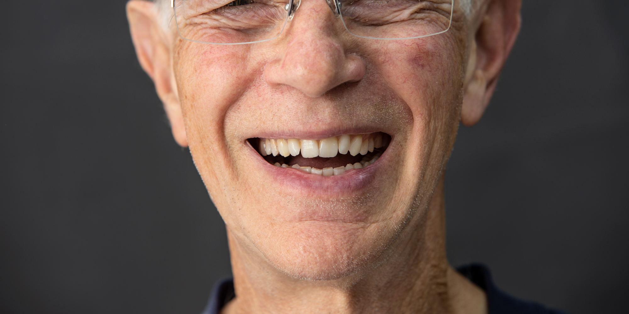 _RCW9731-Norm-V1.jpg Fabulous Teeth by Ron Winter @ Seaside Dental Laboratory & Clinic