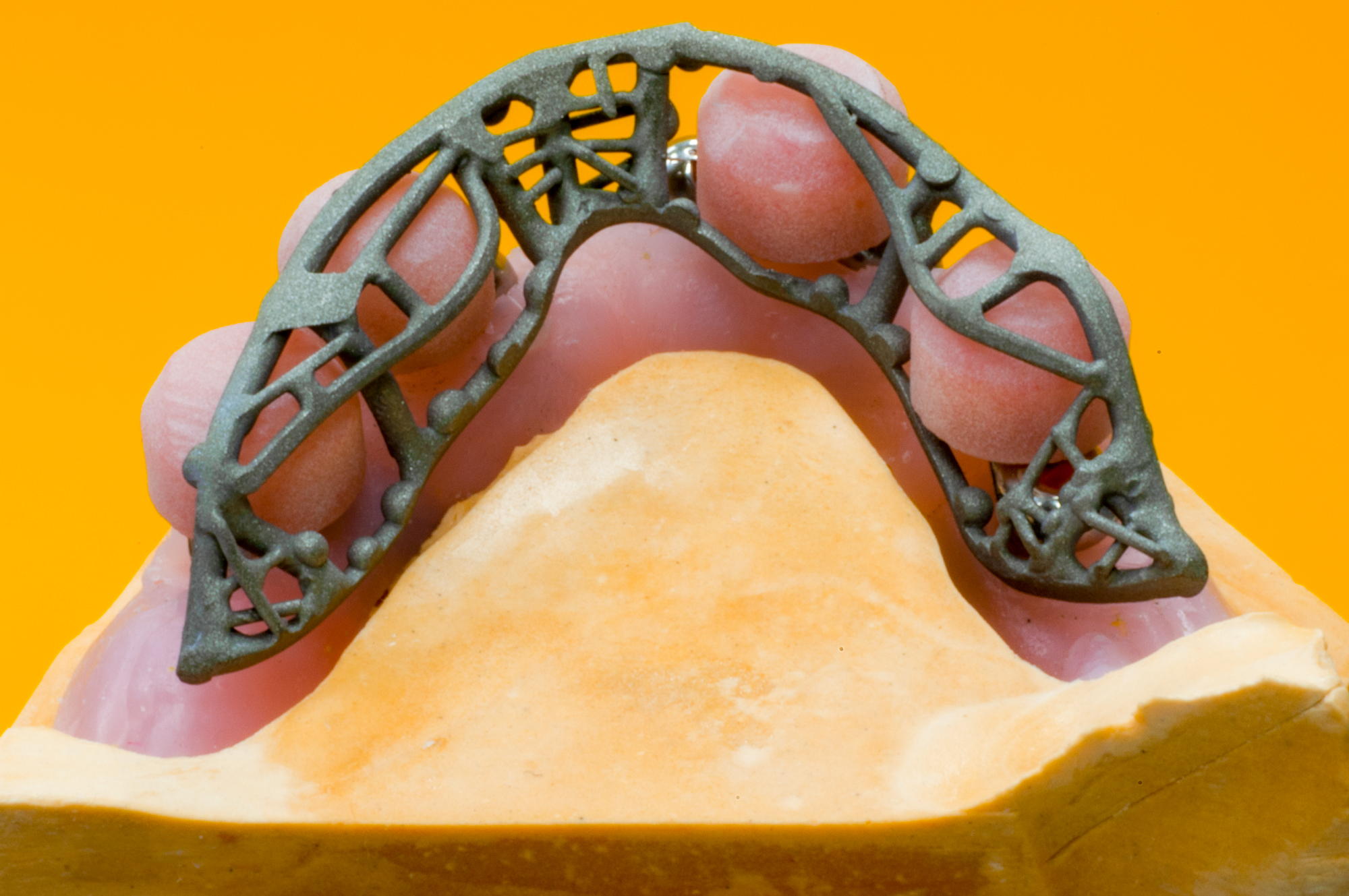 _RCW3190-Big-Balls-Over-Denture-Sub-Frame.jpg