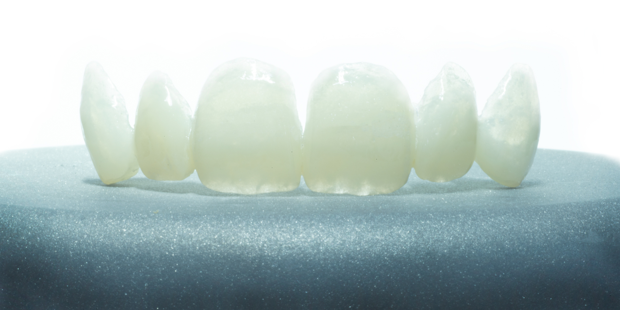 _RCW4740-Rons-ClipOn-Smile-by-Ron-Winter-of-Fabulous-Teeth--Seaside-Dental-Laboratory--Clinic.jpg